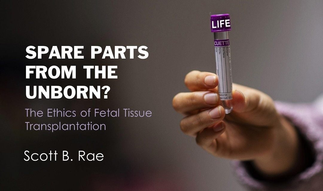 Spare Parts from the Unborn: The Ethics of Fetal Tissue Transplantation