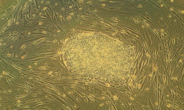 Should Christians support a ban on embryonic stem cell research?