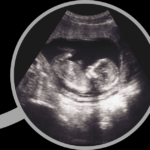 Episode 75: The Problem with Improving Abortion