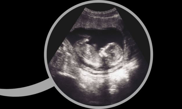 Episode 75: The Problem with Improving Abortion